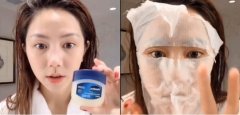 凡士林是史上最强保湿面膜？并非人人适合暗疮粉刺者忌用
