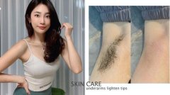 腋下黑怎么能迅速变白 腋下美白技巧让你露出腋下也不尴尬