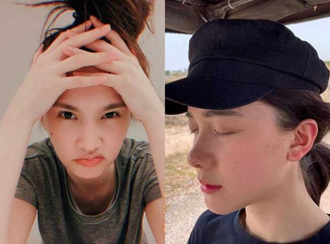 针清去黑头可致细菌感染 教你有效方法去黑头不怕出意外