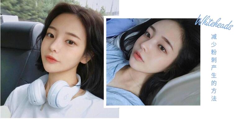 怎么快速去除粉刺小妙招 这5个方法可以制粉刺的产生
