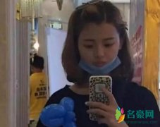 杨超越整容照片曝光 以前单眼皮变成了现在双眼皮