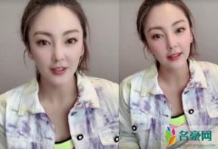 张雨绮近照曝光再变脸 网友：这是整容失败了吗？