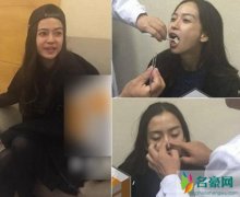 baby整容鉴定是真的吗？医生亲自说出了鉴定过程