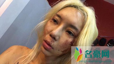 女模Leng Yein被家暴两年才狠心分手 一味迁就换不来悔过