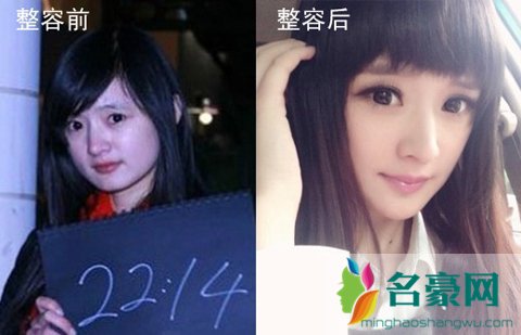 小杨幂陈丹婷整容前后 小杨幂陈丹婷素颜