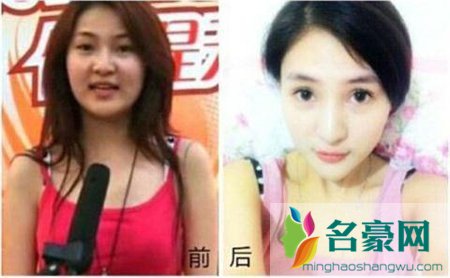 郭美美整容前后照片 郭美美整容前旧照