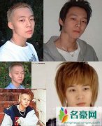 朴有天整容前后照片 朴有天承认自己整容