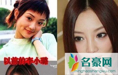 李小璐整容前后照片 李小璐整容后好丑