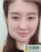 乔欣脸肿成特效 脸肿弧度超夸张仿佛加了特效一样