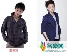 exo张艺兴整容前后照片及资料 exo张艺兴摔倒腰伤