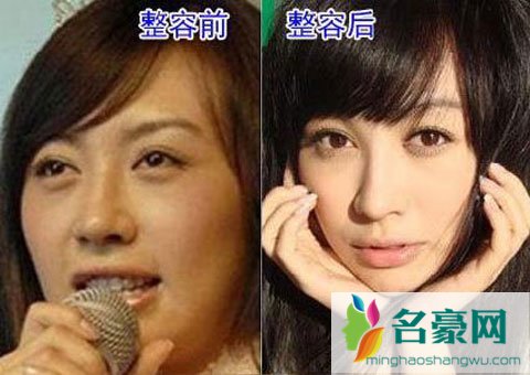 李菲儿整容了吗 李菲儿整容前后照片对比