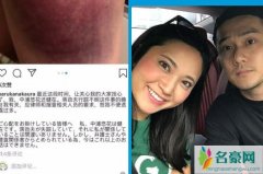 蒋劲夫女友流产事件始末 蒋劲夫家暴中浦悠花真实原因揭露