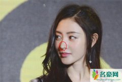张天爱鼻子整过吗 整容前后对比简直判若两人真的整过吗