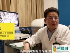 徐峥回应成脱发典型 自嘲错过偶像派