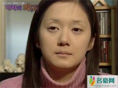 张娜拉整容了吗 张娜拉整容前后对比