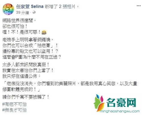 无良商家用Selina照片ps打去疤广告 戳人家痛处太无耻