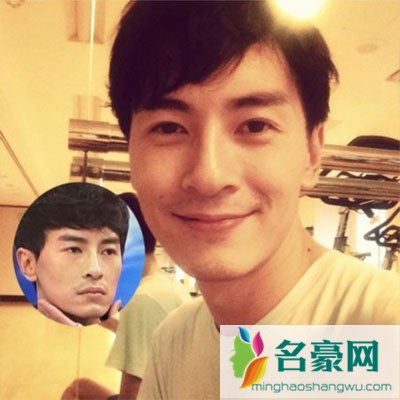 郑元畅是不是整容了 郑元畅为什么整容