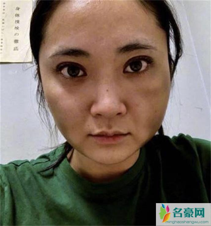 蒋劲夫女友被打照