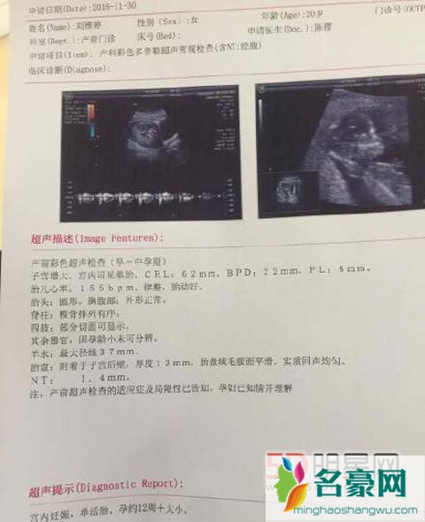 《中国好声音》学员刘雅婷带孕举办婚礼 婚礼风格独特