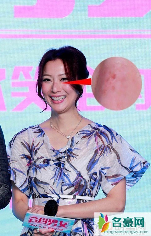 郑秀文曝光近照 皮肤暗淡有雀斑