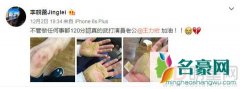 王力宏拍戏受伤 遭到妻子的心疼