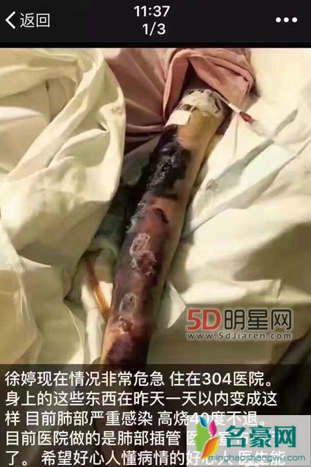 90后女演员徐婷淋巴癌去世 生前压力巨大为家人还债