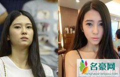 刘晓宇绯闻女友钟鹿纯整容对比照流出 前后差距大