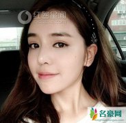 李毓芬承认喜欢罗志祥吗 李毓芬做了哪些整容